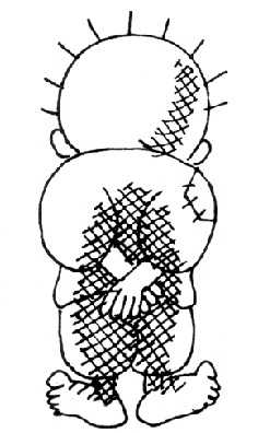 Handala, a cartoon of a refugee child